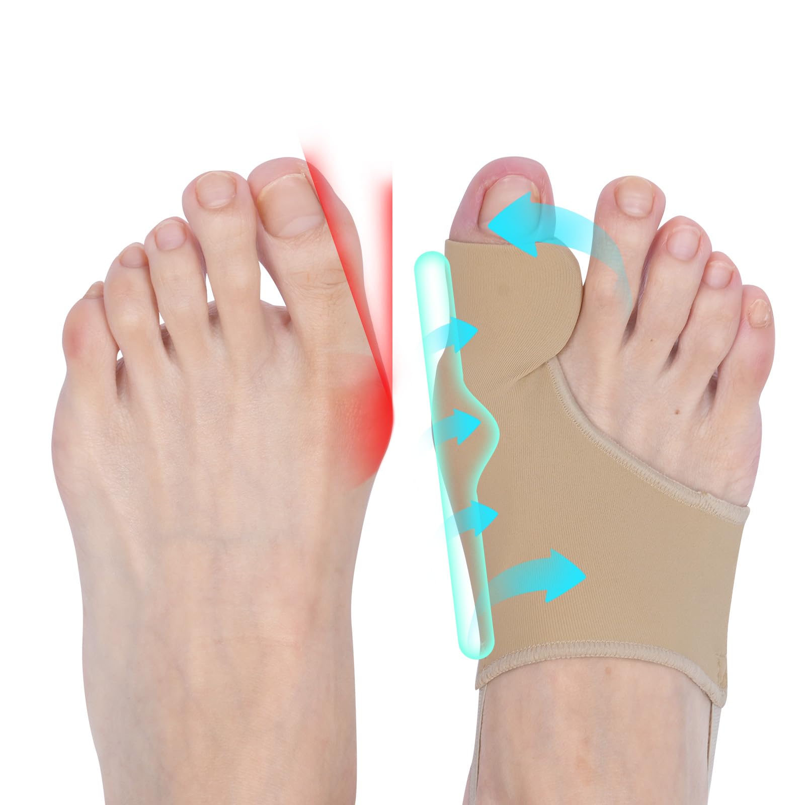 OrtoToe™ – Corrector de Juanetes – Previene el avance sin cirugía en solo 15 minutos al día